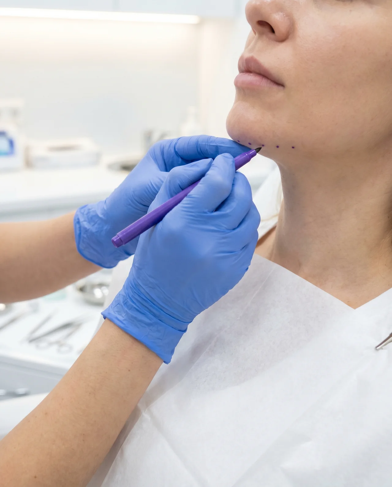 Kybella at Med Spa Myrtle Beach