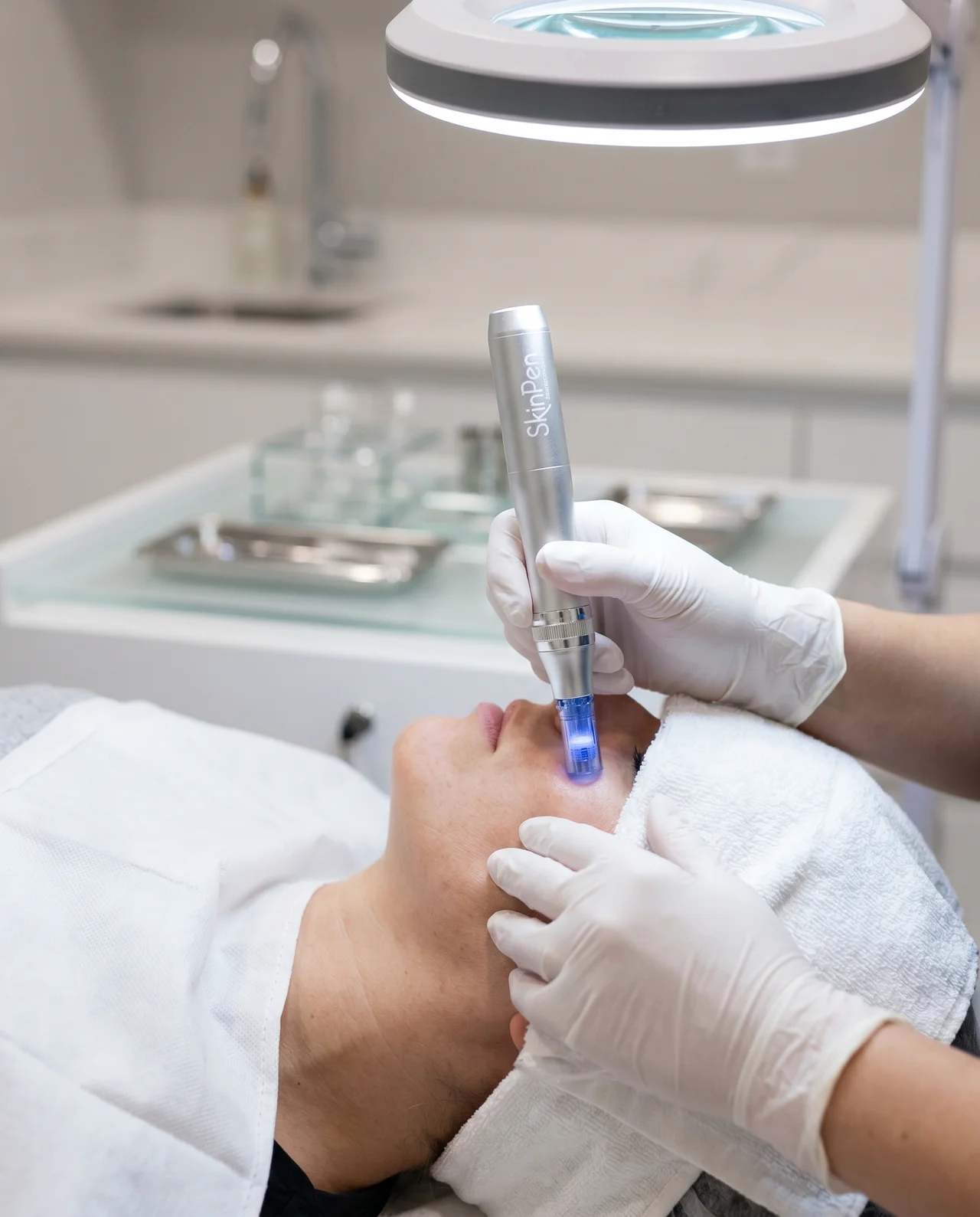 Microneedling at Med Spa Myrtle Beach