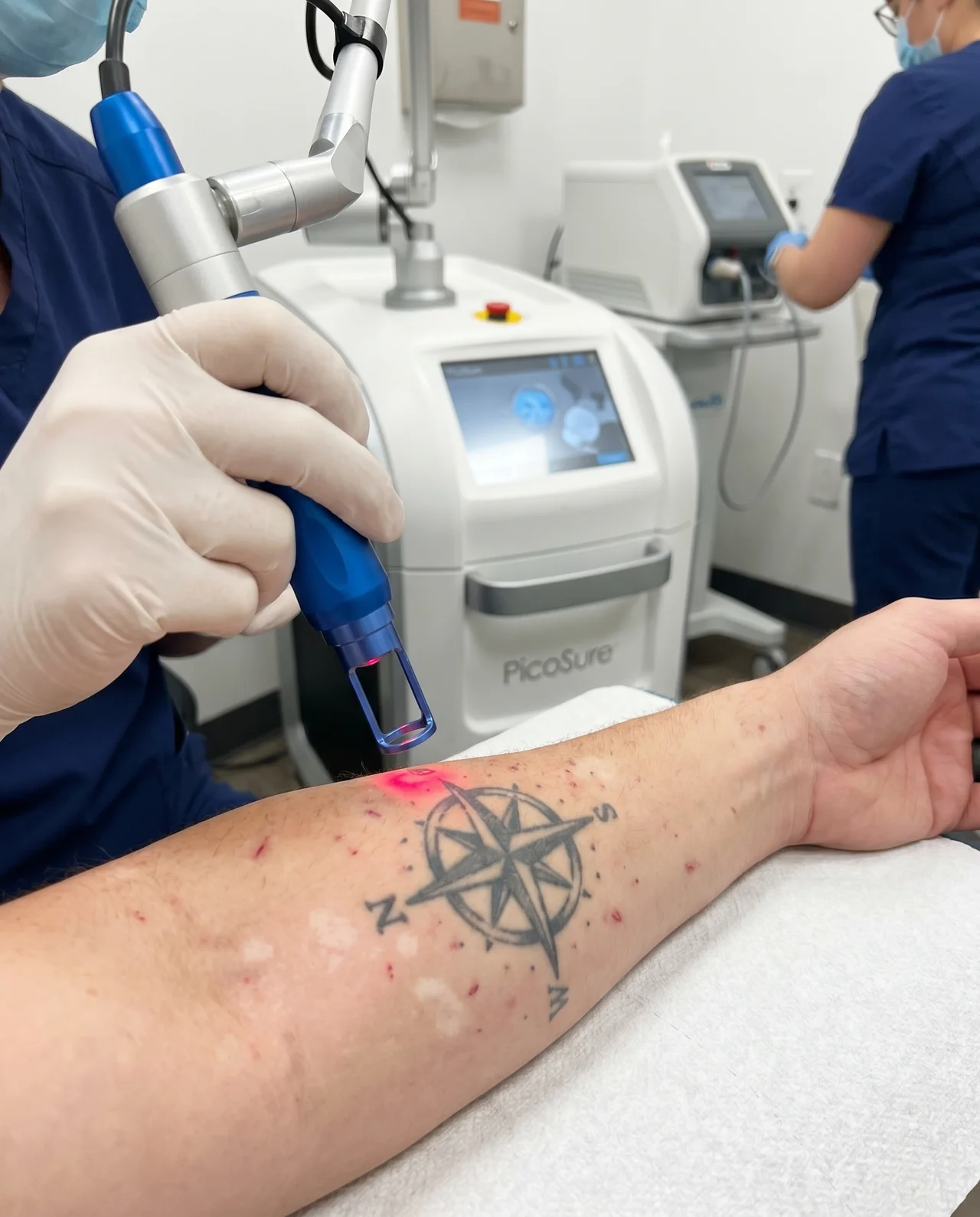 Tattoo Removal at Med Spa Myrtle Beach